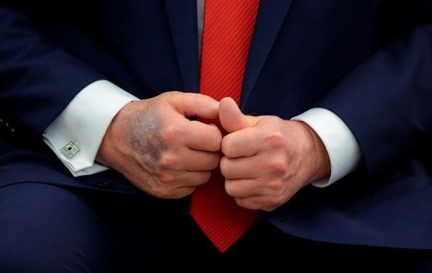 Новини світу - Трамп розповів, звідки у нього синці на руках